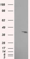 PLEK / Pleckstrin Antibody (clone OTI3E2)