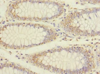 ERBB2IP / Erbin Antibody