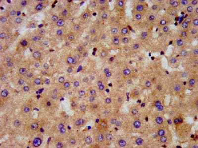Polyclonal Rabbit anti-Human C6orf134 / ATAT1 Antibody (IHC, WB)