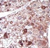 Polyclonal Rabbit anti-Human PCK1 Antibody (aa40-70, IHC, WB)