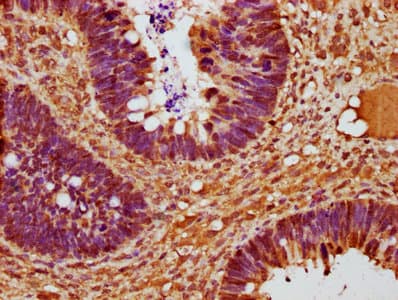 CCND2 / Cyclin D2 Antibody (aa1-289)