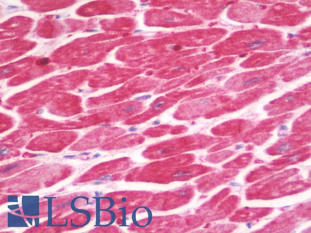 Polyclonal Rabbit anti-Human IL1RL2 Antibody (IHC, IF, WB)