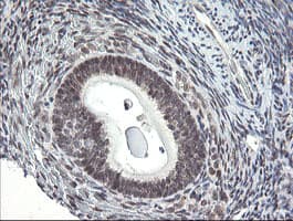 GORAB / SCYL1BP1 Antibody (aa35-394, clone OTI4F11, Carrier-free)