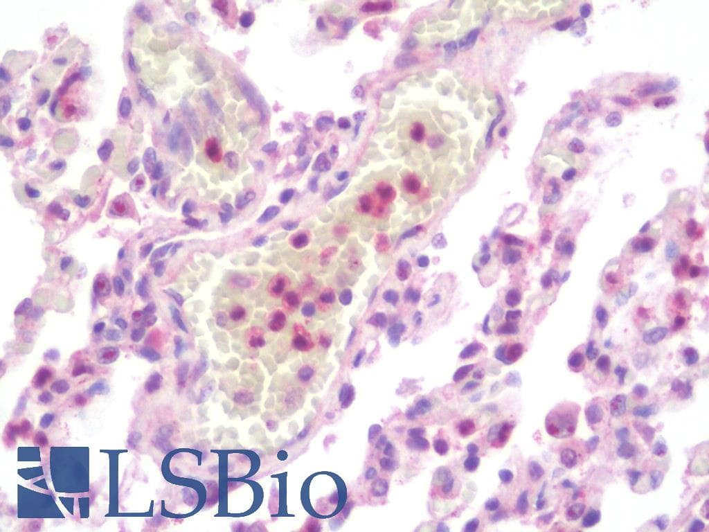 IHC-plus™ MMP9 / Gelatinase B Antibody