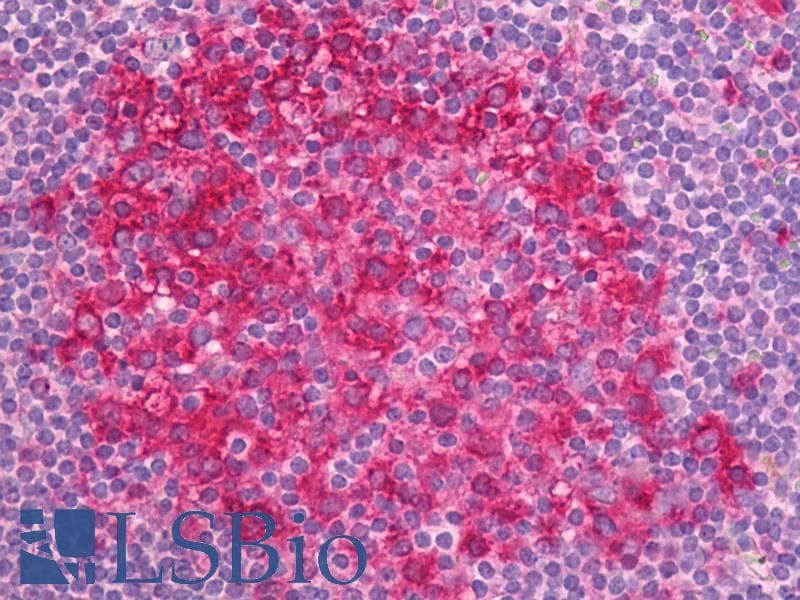 IHC-plus™ Alpha Tubulin Antibody (N-Terminus, clone TU-01, FITC)