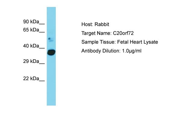 Polyclonal Rabbit anti-Human MGME1 / C20orf72 Antibody (C-Terminus, WB)