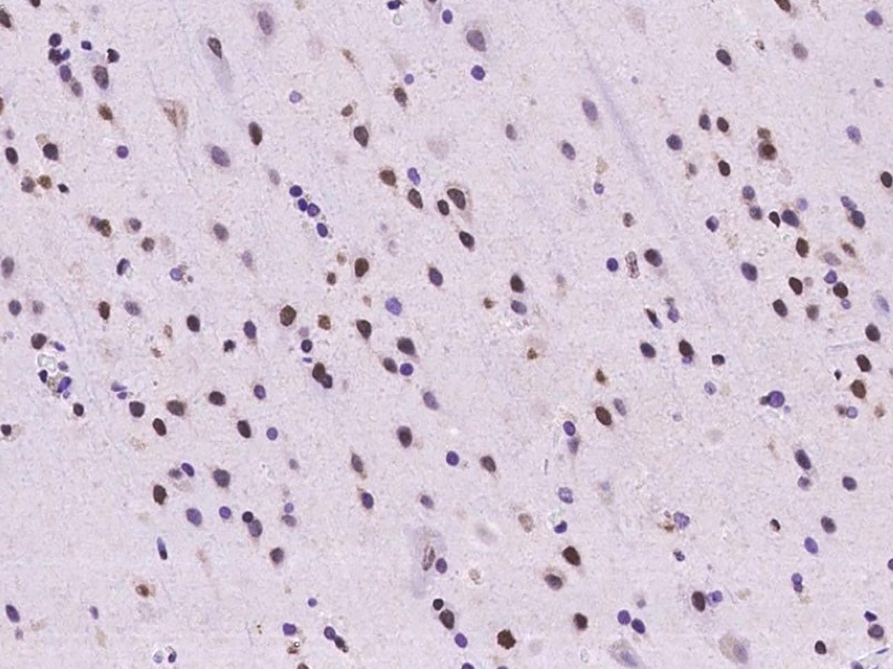 SAFB2 Antibody
