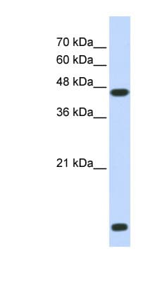 Polyclonal Rabbit anti-Human HDAC8 Antibody (N-Terminus, WB)