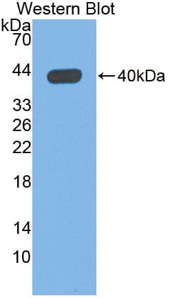 QPCT / QC Antibody (aa29-361, HRP)