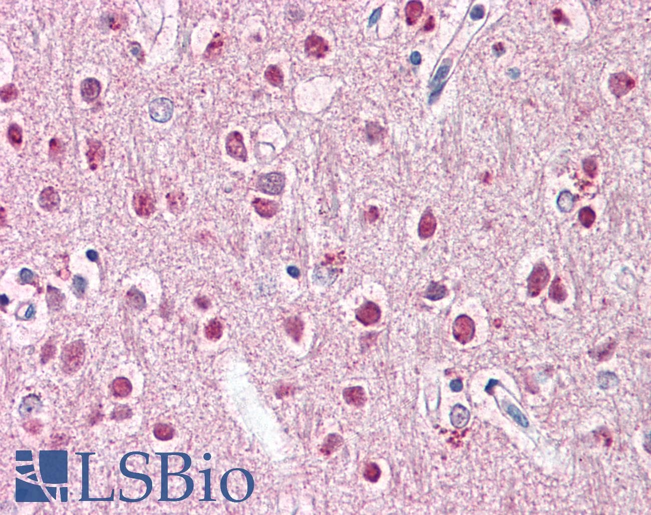 ZNF238 Antibody (aa107-156)