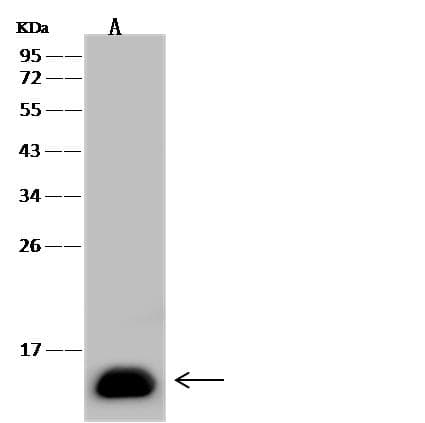 FABP1 / L-FABP Antibody (clone 06, Preservative Free)