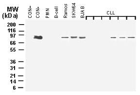 Polyclonal Rabbit anti-Human MALT1 Antibody (aa646-885, IHC, WB)