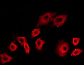 Polyclonal Rabbit anti-Human PIK3R1 / p85 Alpha Antibody (phospho-Tyr199,phospho-Tyr467, IF, WB)