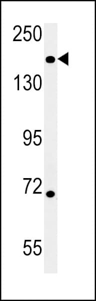 DIS3L Antibody (aa195-224)