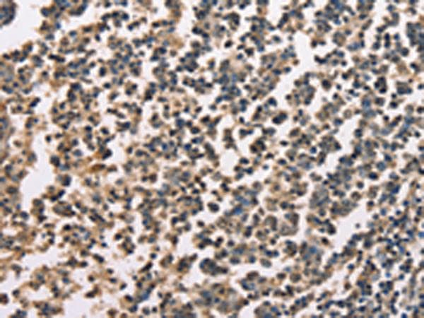ZFYVE19 Antibody