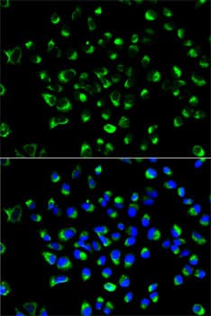 IHC-plus™ PDI / P4HB Antibody