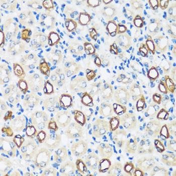 AQP2 / Aquaporin 2 Antibody