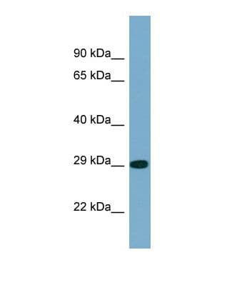 PP2Ac / PPP2CA Antibody (aa62-111)