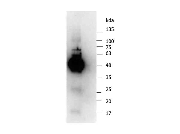 IKBKG / NEMO / IKK Gamma Antibody