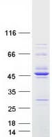 Human RCCD1 Protein (Recombinant Myc-DDK (Flag))