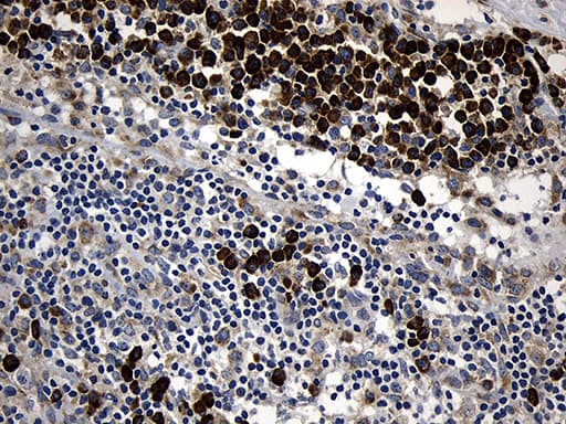 CCDC22 Antibody (clone OTI2E4)