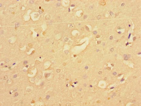 NF2 / Merlin Antibody