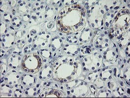 Monoclonal Mouse anti-Human SLA2 / SLAP2 Antibody (clone OTI1E7, IHC, WB)