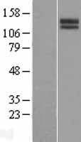 SLITRK3 Protein (Over-Expression Lysate Myc-DDK (Flag))