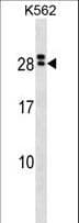 IL15RA Antibody (aa79-106)