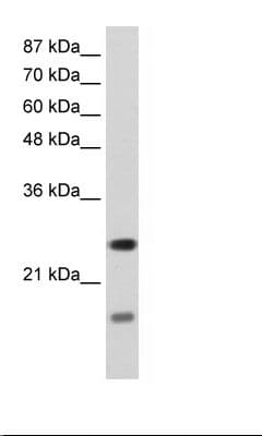 Polyclonal Rabbit anti-Human SRP14 Antibody (aa38-87, IHC, WB)