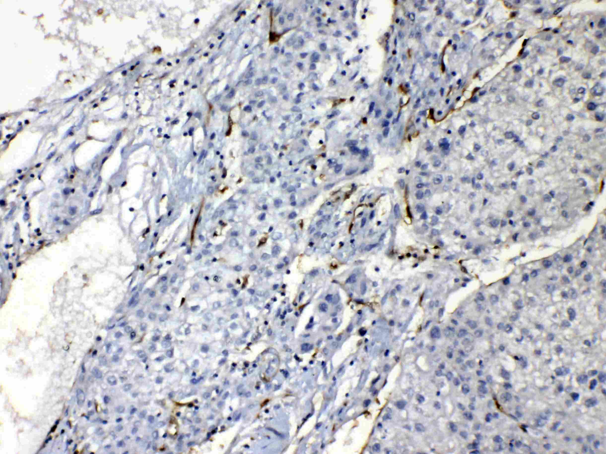 Polyclonal Rabbit anti-Human PNP / Nucleoside Phosphorylase Antibody (IHC, WB)