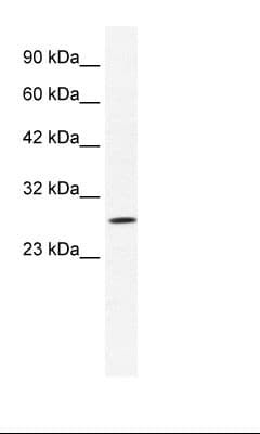 CLIC1 / NCC27 Antibody (aa62-111, Biotin)