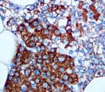 Monoclonal Mouse anti-Human PTH / Parathyroid Hormone Antibody (Ready-to-Use, IHC)
