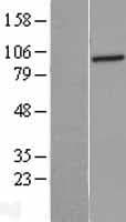 Human PFKL Protein (Over-Expression Lysate Myc-DDK (Flag))