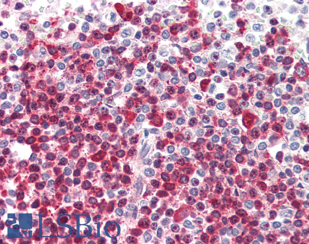 IHC-plus™ Polyclonal Goat anti-Human DKC1 / Dyskerin Antibody (aa446-460, IHC)