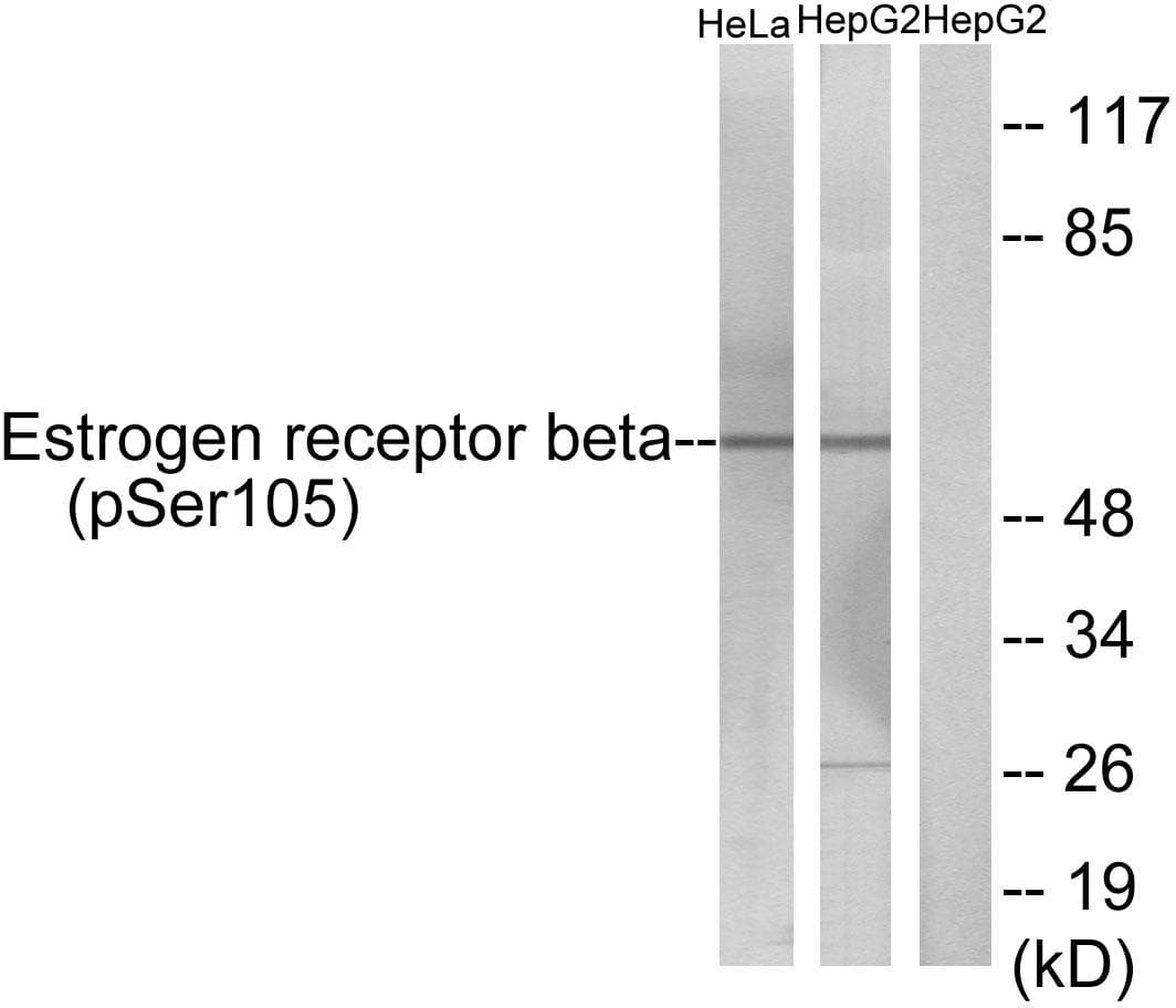 Polyclonal Rabbit anti-Human ESR2 / ER Beta Antibody (phospho-Ser105, IF, WB)