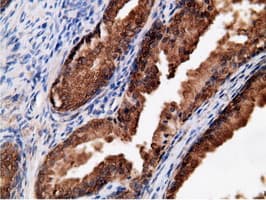 EPHX2 / Epoxide Hydrolase 2 Antibody (clone OTI1H5)