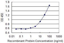 ADORA3 / Adenosine A3 Receptor Antibody (clone 1A3)