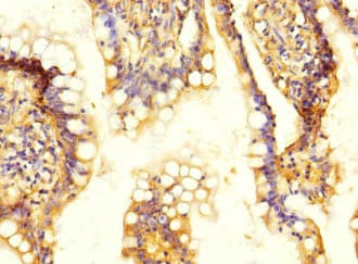 Polyclonal Rabbit anti-Human SLC13A2 / NaCT Antibody (IHC, WB)