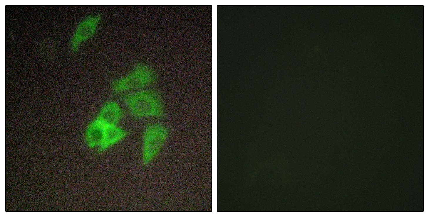 ST14 / Matriptase Antibody
