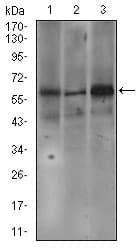 FcERI / Fc Epsilon RI Antibody (aa42-103, clone 1F2A9)