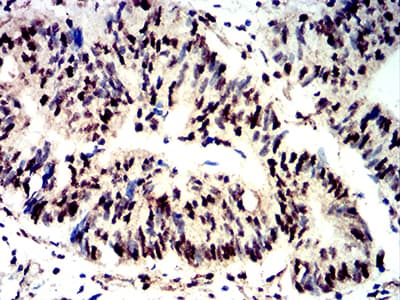 EIF4EBP1 / 4EBP1 Antibody (phospho-Ser65, clone 2D1G11)