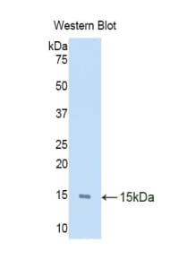S100A7 / Psoriasin Antibody (aa1-101)