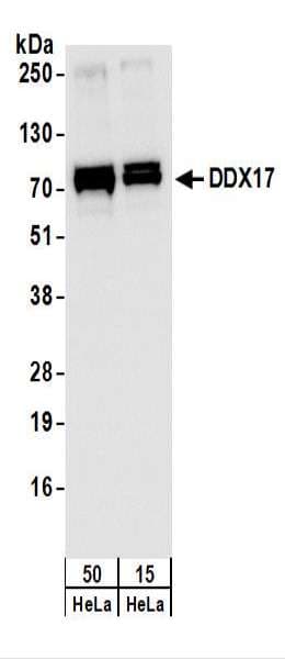 DDX17 Antibody (aa550-C-term)