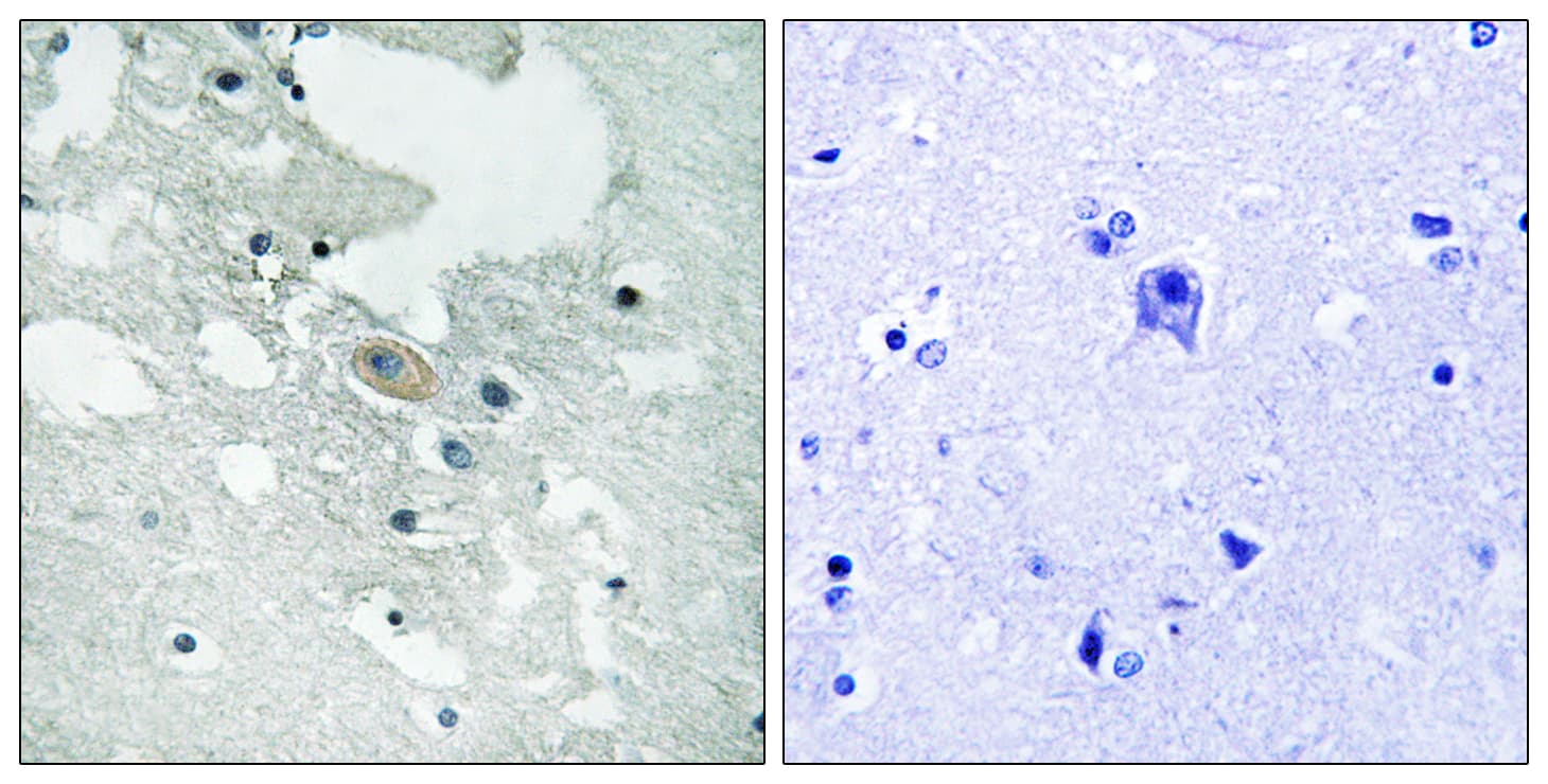 BLNK Antibody (phospho-Tyr84)