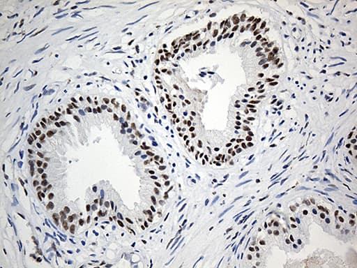 ELL / MEN Antibody (aa302-621, clone OTI1G2)