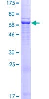 Human WDR92 Protein (Recombinant GST)