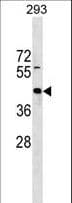 Polyclonal Rabbit anti-Human ZNF331 Antibody (aa72-99, WB)