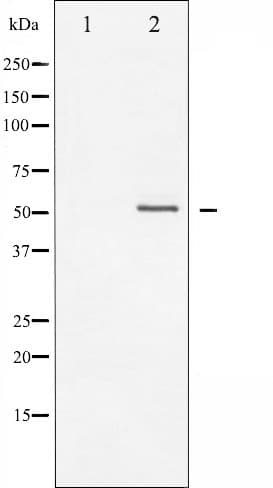 Polyclonal Rabbit anti-Human Vimentin Antibody (phospho-Ser56, IHC, IF, WB)