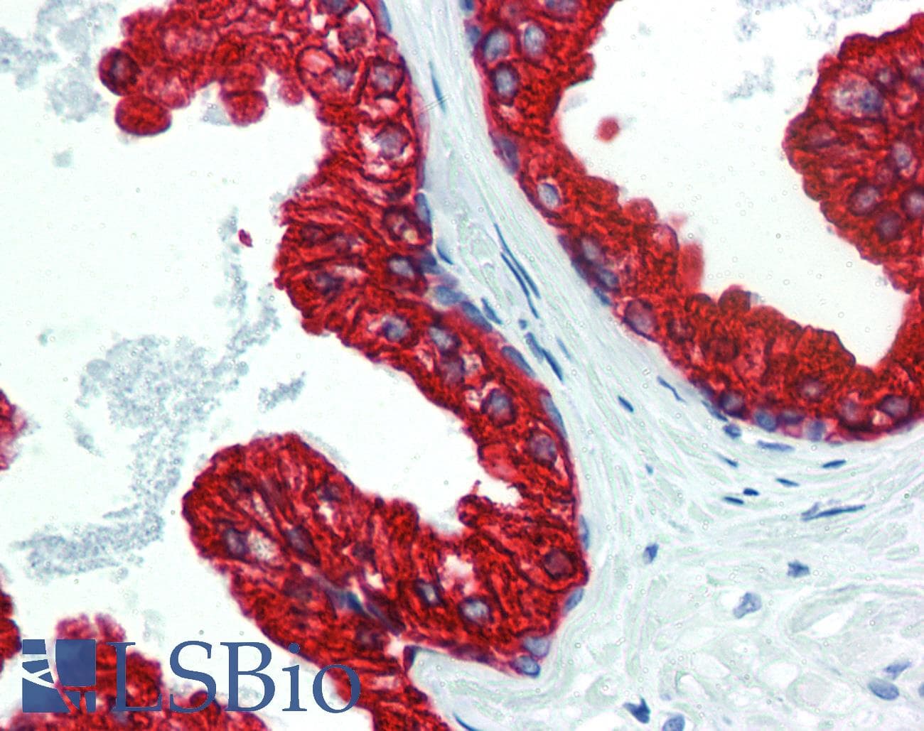PathPlus™ KRT18 / CK18 / Cytokeratin 18 Antibody (C-Terminus, clone R20-H)